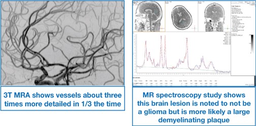 3T_mri_dr_chao_jfm14