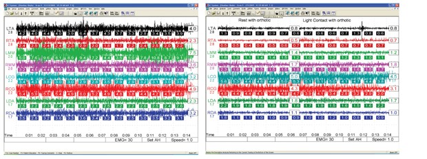 all_about_smiles_TMD_chart