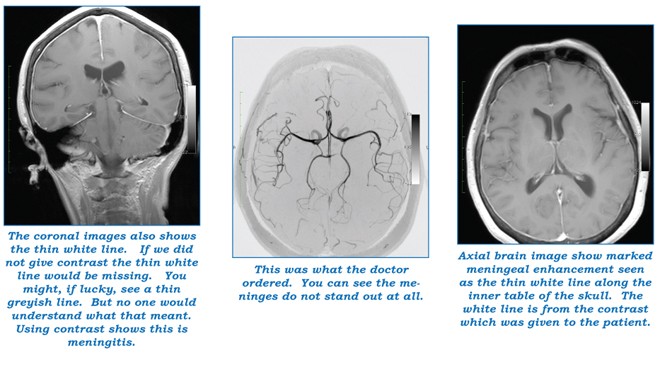 3t_mri_pics_amj16