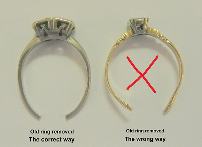 sayers_ring_removal_ond17