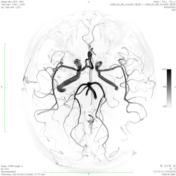 3T_MRI_fm13